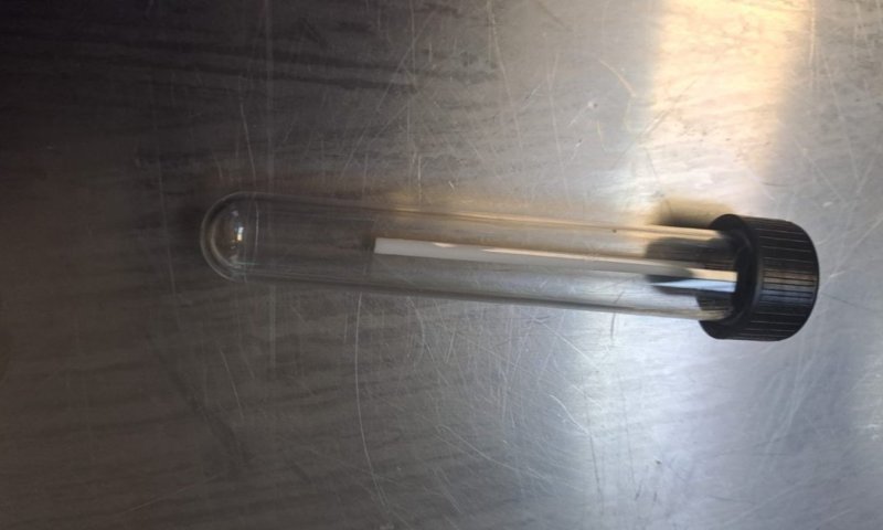 סכנה על מקל: הסוכרייה התמימה ממסיבת חנוכה שהסתיימה בחדר הניתוח