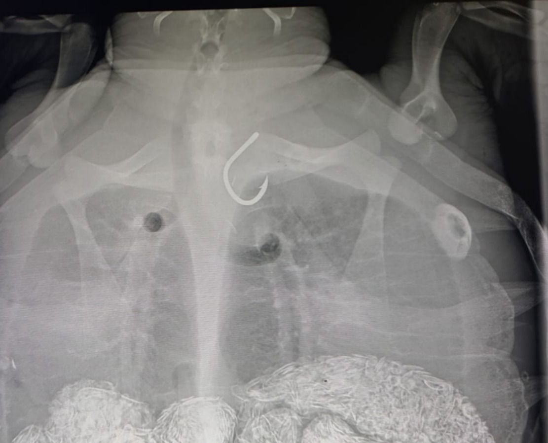 גיא איבגי, רט"ג