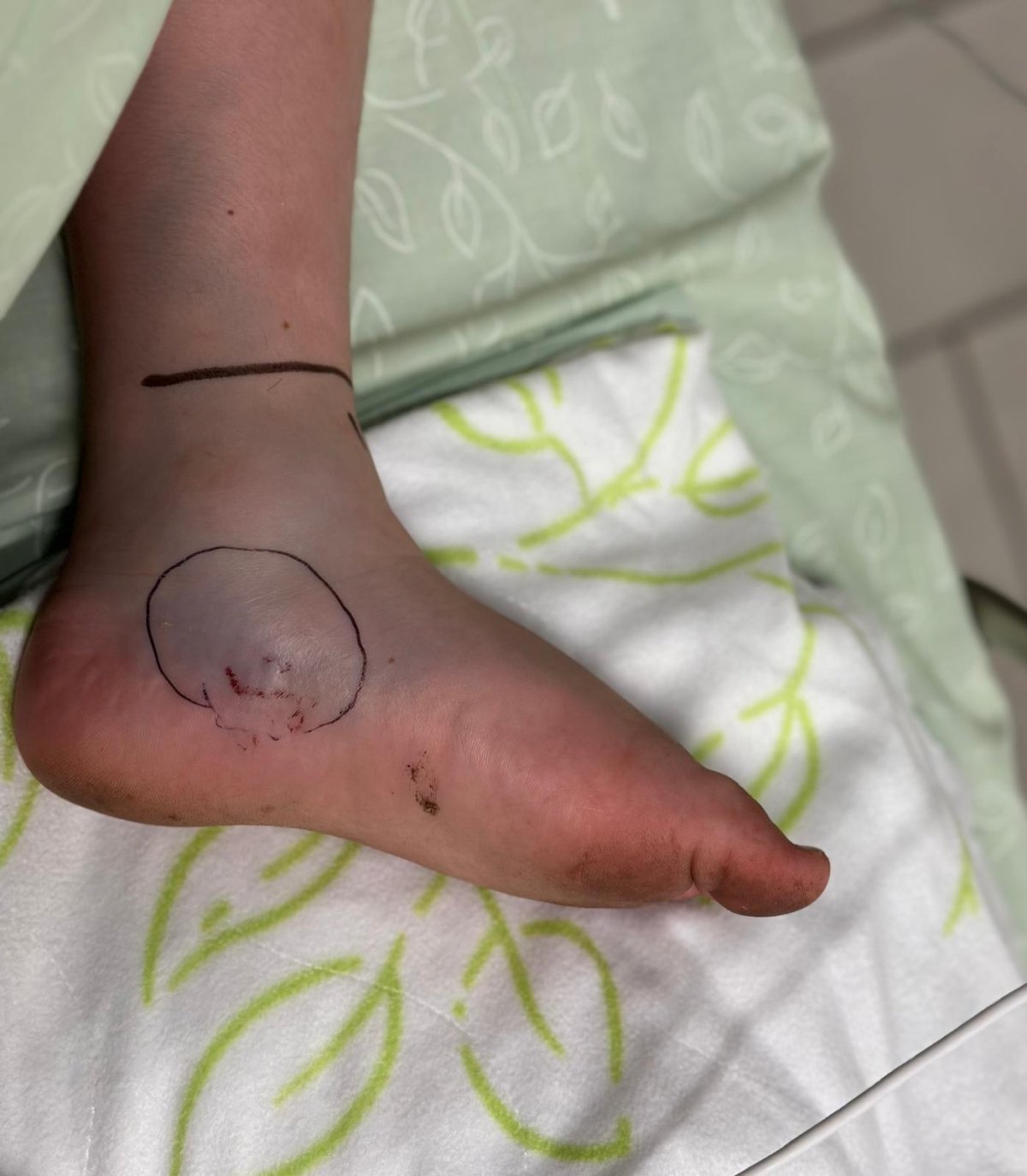 בית חולים אסותא אשדוד