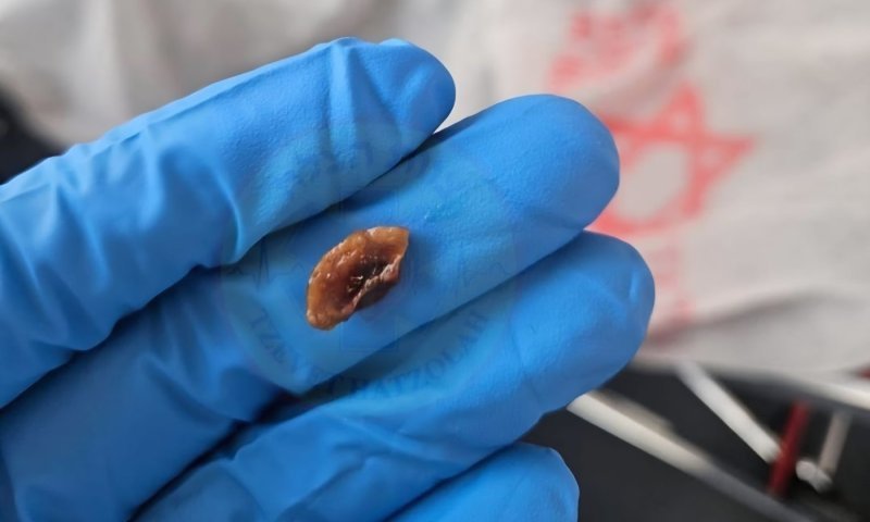 הפעוט נכנס לסכנת חיים בעקבות אכילת פירות ט'ו בשבט