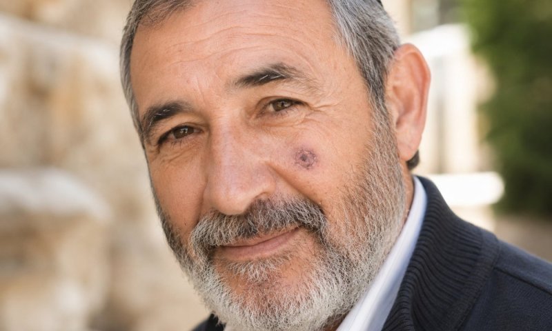 חשופים לשמש וסובלים מפגעי שמש? יתכן שאתם זכאים לפיצוי מהמדינה