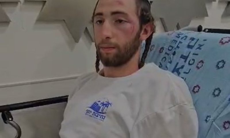 פצוע הפיגוע משחזר: ״עברתי לינץ׳, איבדתי את ההכרה״