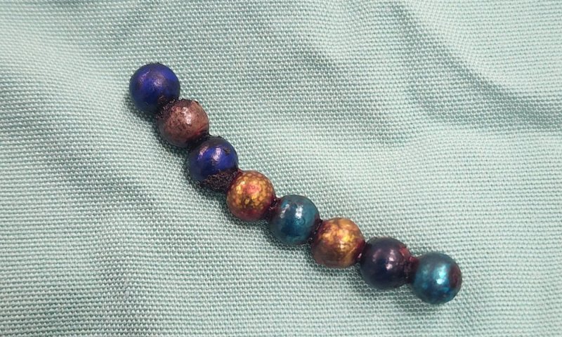 פעוט בן 4 הובהל לבית חולים - בלע 8 מגנטים