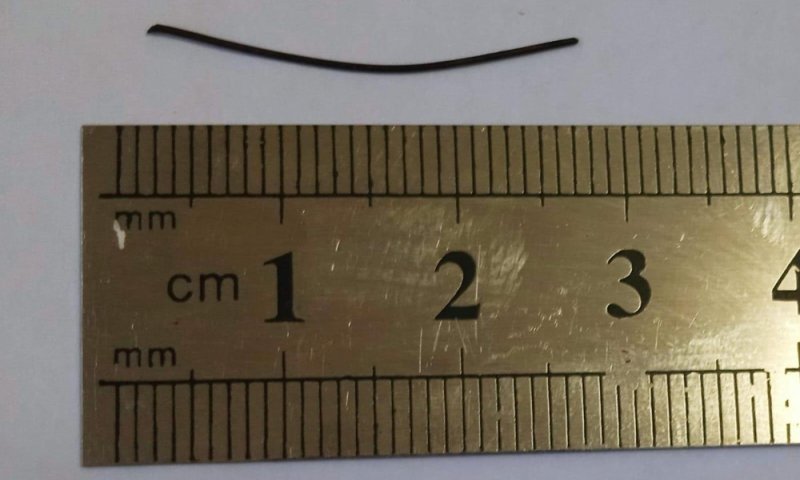 "שרשרת ניסים": הרופאים שלפו ברזל חד באורך של שלושה ס"מ מהגוף