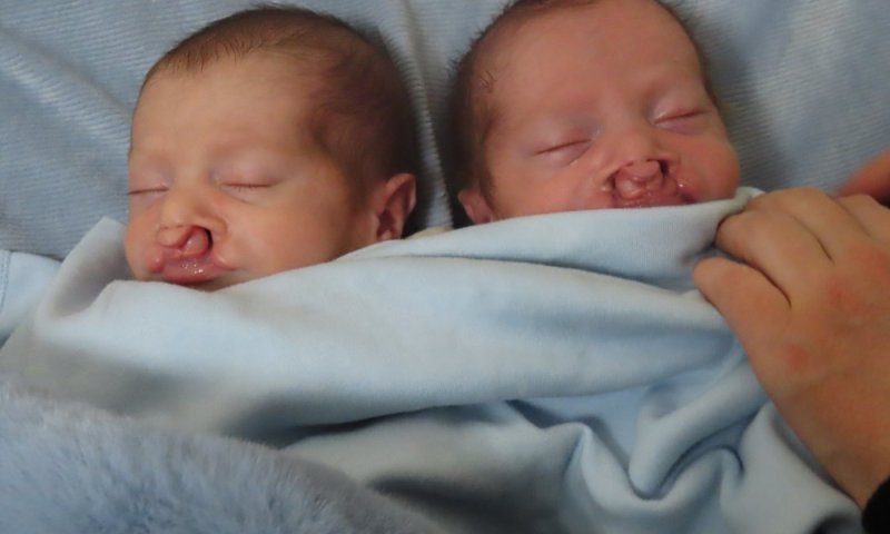 הצילו את חזקי ומיילך: "אם לא נגייס 80,000$ - לא תהיה להם הזדמנות נוספת"