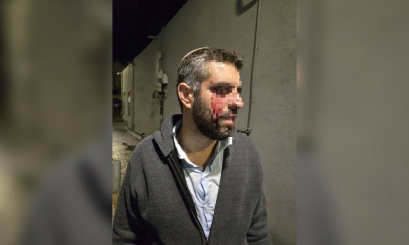 נעצר חשוד בתקיפת הרב ביפו בשבוע שעבר, זה מה שנתפס בביתו